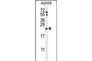 Western blot analysis in A2058 cell line lysates (35ug/lane).
