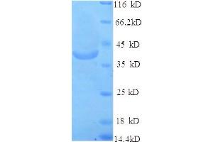 SDS-PAGE (SDS) image for Solute Carrier Family 27 (Fatty Acid Transporter), Member 2 (SLC27A2) (AA 283-620), (Cytoplasmic Domain), (Cytosolic) protein (His tag) (ABIN5713840) (SLC27A2 Protein (AA 283-620, Cytoplasmic Domain, Cytosolic) (His tag))