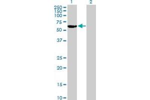 Western Blot analysis of RARG expression in transfected 293T cell line by RARG MaxPab polyclonal antibody. (Retinoic Acid Receptor gamma anticorps  (AA 1-454))