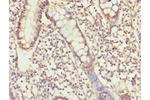 Immunohistochemistry of paraffin-embedded human small intestine tissue using ABIN7174300 at dilution of 1:100 (USP26 anticorps  (AA 664-913))
