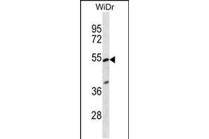 Western blot analysis in WiDr cell line lysates (35ug/lane). (PIGV anticorps  (C-Term))