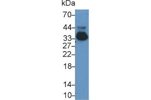 Detection of APOE in Rat Serum using Monoclonal Antibody to Apolipoprotein E (APOE) (APOE anticorps  (AA 19-168))