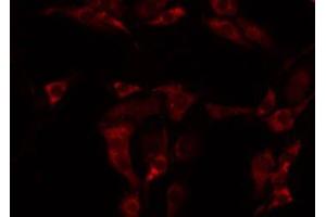 ABIN6275043 staining NIH-3T3 by IF/ICC. (GARP anticorps  (Internal Region))