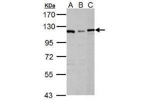 WB Image Sample (30 ug of whole cell lysate) A: Raji B: K562 C: NCI-H929 7. (DPYD anticorps)
