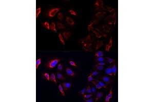 Immunofluorescence analysis of U2OS cells using SAA3 antibody. (Serum Amyloid A3 Pseudogene (SAA3P) anticorps)