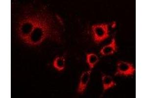 Immunofluorescent analysis of LIM staining in HepG2 cells. (PDLIM5 anticorps)