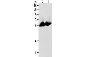 Western Blotting (WB) image for anti-Matrix Metallopeptidase 11 (Stromelysin 3) (MMP11) antibody (ABIN2431667)