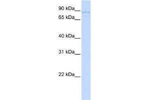 WB Suggested Anti-SLITRK6 Antibody Titration:  0. (SLITRK6 anticorps  (N-Term))