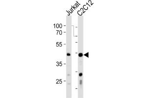 Western Blotting (WB) image for anti-Polymerase (DNA-Directed), delta Interacting Protein 3 (POLDIP3) antibody (ABIN3001314) (POLDIP3 anticorps)