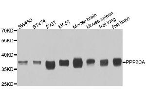 Western blot analysis of extracts of various cell lines, using PPP2CA antibody. (PPP2CA anticorps  (AA 1-309))