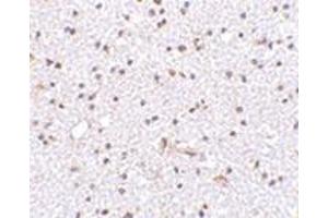 Immunohistochemistry of TOCA-1 in human brain tissue with this product at 2.