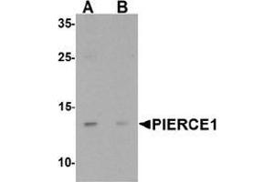 Western blot analysis of PIERCE1 in A20 cell lysate with PIERCE1 Antibody  at 1 µg/mL in (A) the absence and (B) the presence of blocking peptide. (C9ORF116 anticorps  (N-Term))