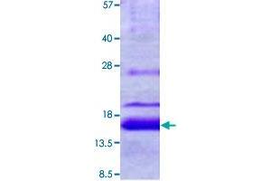 Image no. 1 for X Antigen Family, Member 1D (XAGE1D) (AA 1-81) protein (His tag) (ABIN5570639)