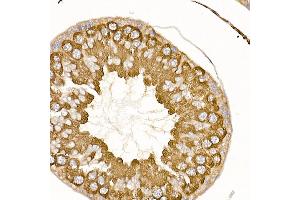 Immunohistochemistry of paraffin-embedded rat testis using [KO Validated] TR Rabbit pAb (ABIN3021164, ABIN3021165, ABIN3021166 and ABIN1513640) at dilution of 1:250 (40x lens).