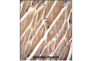 PIP5KL1 Antibody (N-term) (ABIN655244 and ABIN2844847) immunohistochemistry analysis in formalin fixed and paraffin embedded human skeletal muscle followed by peroxidase conjugation of the secondary antibody and DAB staining.