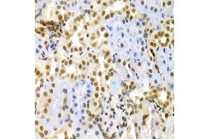 Immunohistochemistry of paraffin-embedded rat kidney using MAPK3 Antibody.