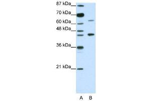 WB Suggested Anti-RARA  Antibody Titration: 1. (Retinoic Acid Receptor alpha anticorps  (N-Term))