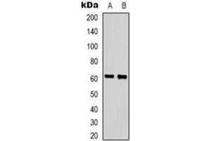 Western blot analysis of ZNF397 expression in HepG2 (A), Hela (B) whole cell lysates.