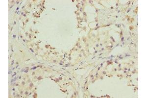 Immunohistochemistry of paraffin-embedded human testis tissue using ABIN7163973 at dilution of 1:100 (KCND1 anticorps  (AA 410-647))
