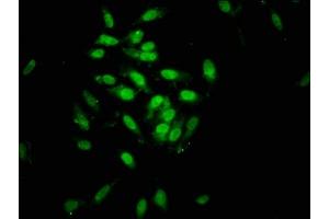 Immunofluorescence staining of Hela cells with ABIN7162487 at 1:133, counter-stained with DAPI. (SIN3B anticorps  (AA 705-769))