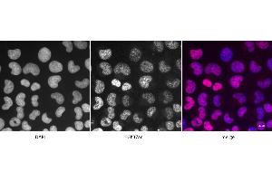 Detection of H3K37ac by immunofluorescence U2OS cells were stained with H3K37ac antibody at a dilution of 1:500.
