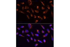 Immunofluorescence analysis of HeLa cells using NDUFS1 Rabbit pAb (ABIN7268819) at dilution of 1:50 (40x lens).