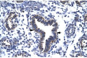 Rabbit Anti-RBM10 Antibody  Paraffin Embedded Tissue: Human Lung Cellular Data: Epithelial cells of bronchiole Antibody Concentration: 4.