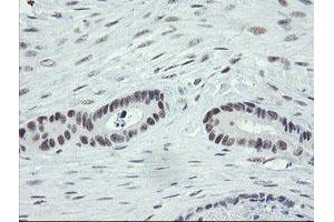 Immunohistochemistry (IHC) image for anti-Zinc Finger, BED-Type Containing 1 (ZBED1) antibody (ABIN1501794)