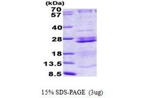 Ribosomal Protein L23A (RPL23A) (AA 1-156) protein (His tag)