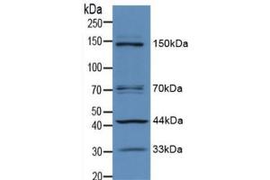 Western blot analysis of Mouse Brain Tissue. (IRS1 anticorps  (AA 837-1089))
