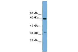 WB Suggested Anti-UBXD3 Antibody Titration: 0. (UBXN10 anticorps  (Middle Region))
