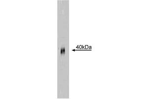 Western blot analysis of recombinant FasÄTM. (FAS anticorps)