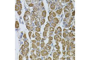 Immunohistochemistry of paraffin-embedded human stomach using UQCRC1 antibody (ABIN5971722) at dilution of 1/100 (40x lens). (UQCRC1 anticorps)