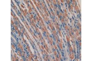 Used in DAB staining on fromalin fixed paraffin- embedded stomach tissue (Chemerin anticorps  (AA 21-155))