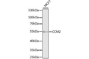 Western blot analysis of extracts of MCF7 cells, using CCM2 antibody. (CCM2 anticorps  (AA 1-300))
