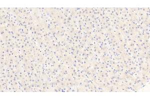 Detection of ACO1 in Human Liver Tissue using Polyclonal Antibody to Aconitase 1 (ACO1)
