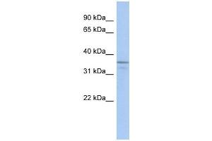 UBLCP1 antibody used at 1 ug/ml to detect target protein. (UBLCP1 anticorps  (N-Term))