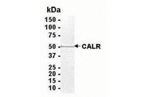 Western Blotting (WB) image for Calreticulin (CALR) (AA 18-417) protein (ABIN2468306)