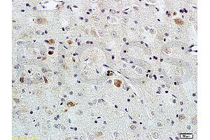 Formalin-fixed and paraffin embedded rat brain tissue labeled with Rabbit Anti-PACAP-38 Polyclonal Antibody (ABIN726215), Unconjugated at 1:200 followed by conjugation to the secondary antibody and DAB staining. (PACAP-38 anticorps  (AA 31-38))