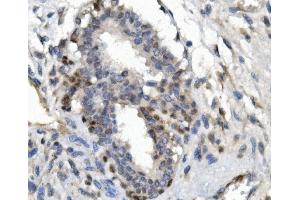 IHC analysis of FOXP1 using anti-FOXP1 antibody (ABIN7602780). (FOXP1 anticorps  (C-Term))