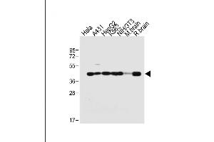 All lanes : Anti-TARDBP Antibody (N-term) at 1:2000 dilution Lane 1: Hela whole cell lysate Lane 2: A431 whole cell lysate Lane 3: HepG2 whole cell lysate Lane 4: K562 whole cell lysate Lane 5: NIH/3T3 whole cell lysate Lane 6: Mouse brain tissue lysate Lane 7: Rat brain tissue lysate Lysates/proteins at 20 μg per lane. (TARDBP anticorps  (N-Term))