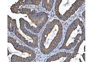 IHC analysis of TMC7 using anti-TMC7 antibody (ABIN7602499).