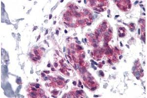 Human Breast: Formalin-Fixed, Paraffin-Embedded (FFPE) (CDC27 anticorps  (C-Term))