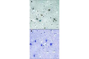 Immunohistochemical staining of human brain tissue by DPYSL2 (phospho T509) polyclonal antibody  without blocking peptide (A) or preincubated with blocking peptide (B) under 1:50-1:100 dilution. (DPYSL2 anticorps  (pThr509))