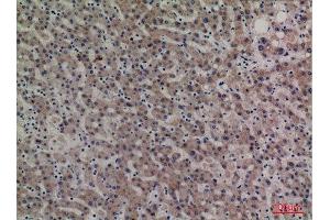 Immunohistochemistry (IHC) analysis of paraffin-embedded Human Liver, antibody was diluted at 1:100. (SERPINA4 anticorps  (Internal Region))