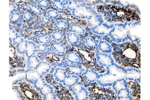 IHC analysis of Icam1 using anti-Icam1 antibody (ABIN7601978). (ICAM1 anticorps  (AA 53-537))