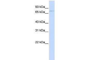 WB Suggested Anti-ABCB8 Antibody Titration:  0.