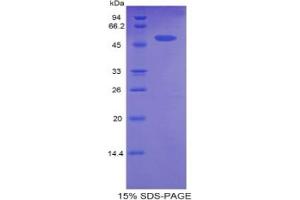 SDS-PAGE analysis of Rat CPT1A Protein.