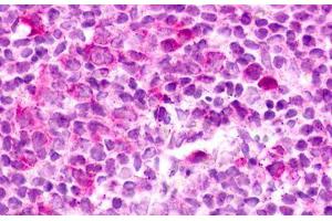 Image no. 1 for anti-G Protein-Coupled Receptor 183 (GPR183) (Cytoplasmic Domain) antibody (ABIN1048771)