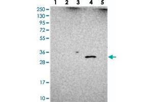 Western blot analysis of Lane 1: RT-4, Lane 2: U-251 MG, Lane 3: Human Plasma, Lane 4: Liver, Lane 5: Tonsil with UTP23 polyclonal antibody  at 1:250-1:500 dilution. (UTP23 anticorps)
